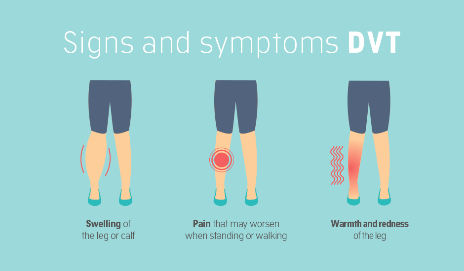 diagram showing symptoms of deep vein thrombosis including leg swelling pain and redness