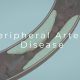 Medical illustration showing artery blockage in the legs from peripheral artery disease