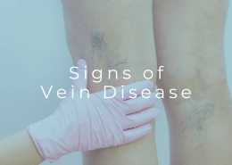 Visible veins in the legs that may indicate vein disease
