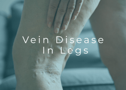 Medical illustration showing vein disease affecting blood circulation in the legs