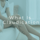 claudication symptoms in the legs