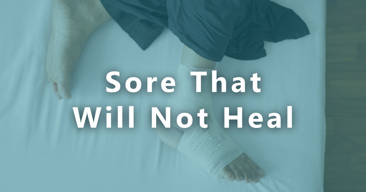 A Sore on Your Leg or Foot That Will Not Heal